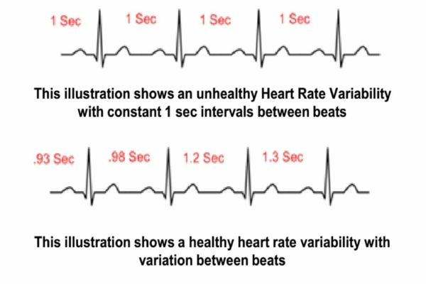 Race day heart rate variability (HRV)